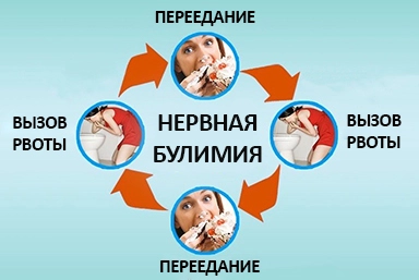 Лечение булимии в Агое
